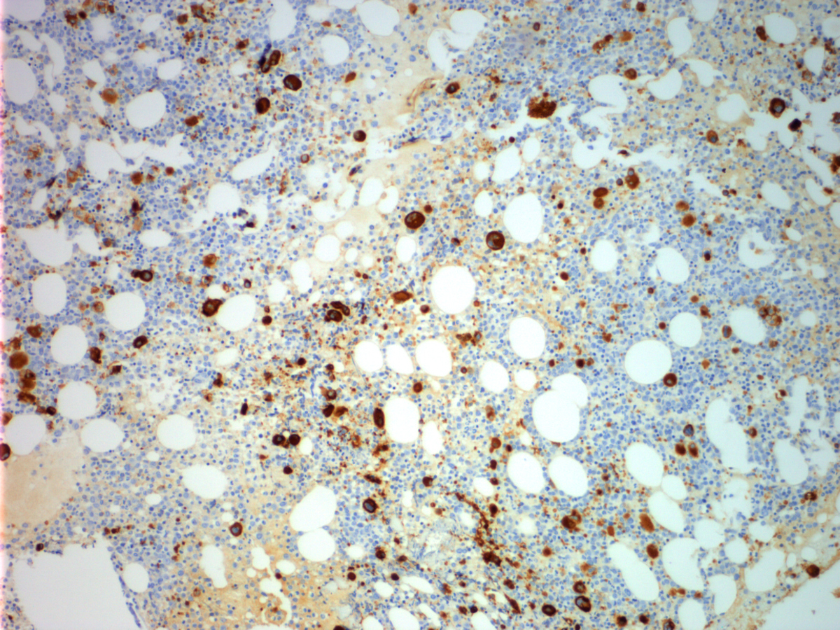 CD42b (low power)